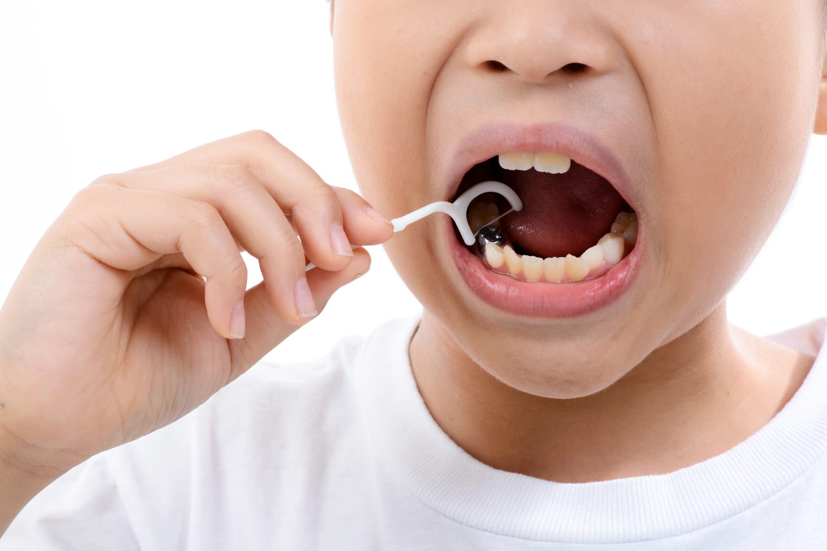 When Should You Start Flossing Your Child's Teeth?